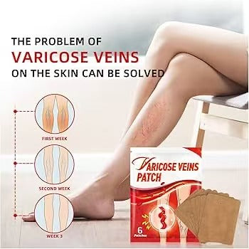 Parche para el alivio de las venas varicosas